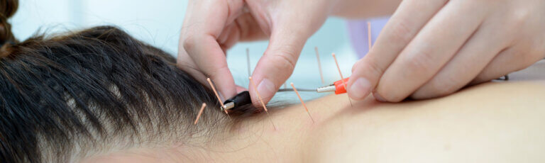 Traditionelle Chinesische Medizin in Baden | Traditionelle chinesische Akupunktur und Elektroakupunktur am Körper des Patienten