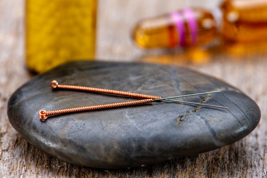 Traditionelle Chinesische Medizin in Baden | Abbildung von homöopathischen Globuli und Akupunkturnadeln