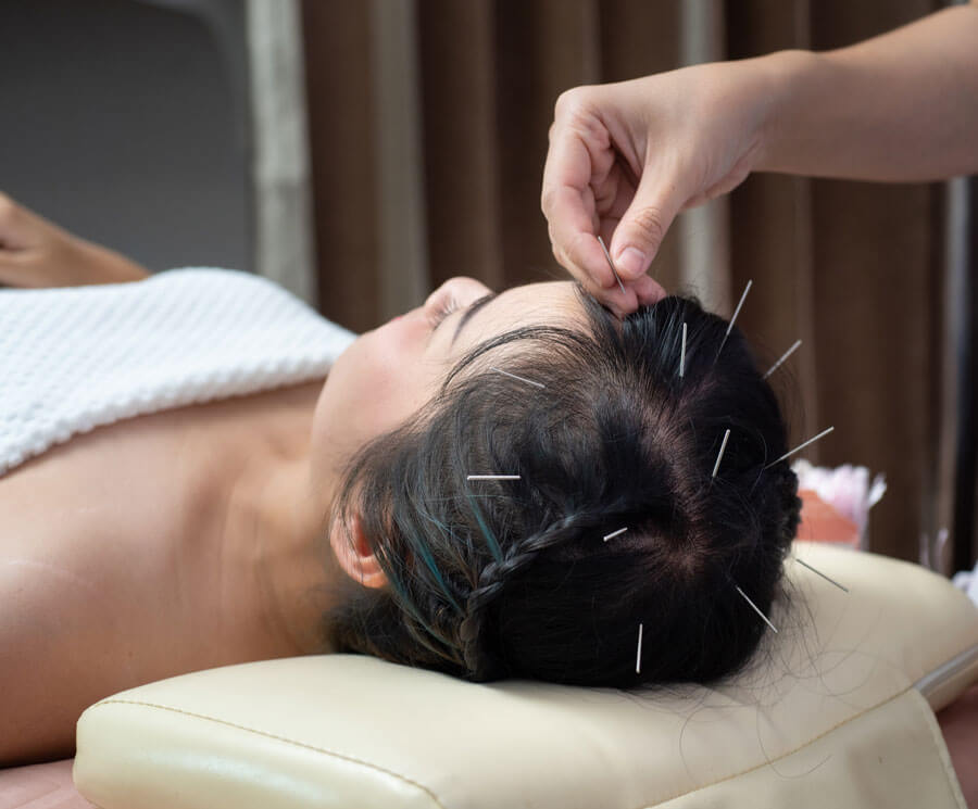 Traditionelle Chinesische Medizin in Luzern | Patient erhält Akupunkturbehandlung am Kopf